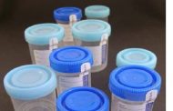 Wholesale Urine Cups For All of us