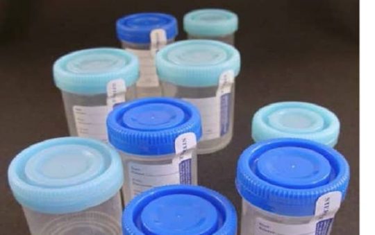 Wholesale Urine Cups For All of us