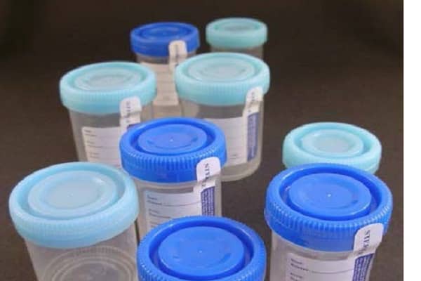 Wholesale Urine Cups For All of us
